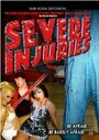 «Severe Injuries» трейлер фильма в хорошем качестве 1080p